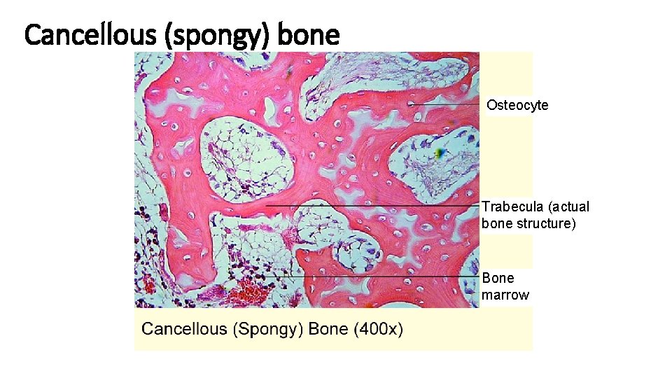Cancellous (spongy) bone Osteocyte Trabecula (actual bone structure) Bone marrow 
