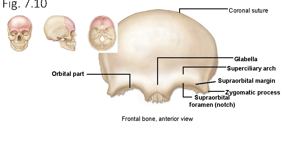 Fig. 7. 10 Coronal suture Glabella Superciliary arch Orbital part Supraorbital margin Zygomatic process