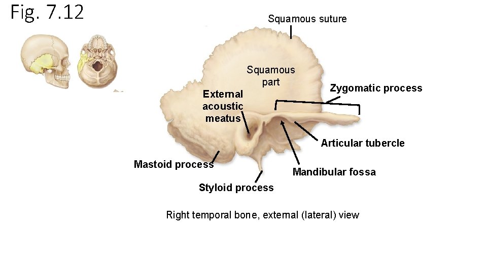 Fig. 7. 12 Squamous suture Squamous part External acoustic meatus Zygomatic process Articular tubercle