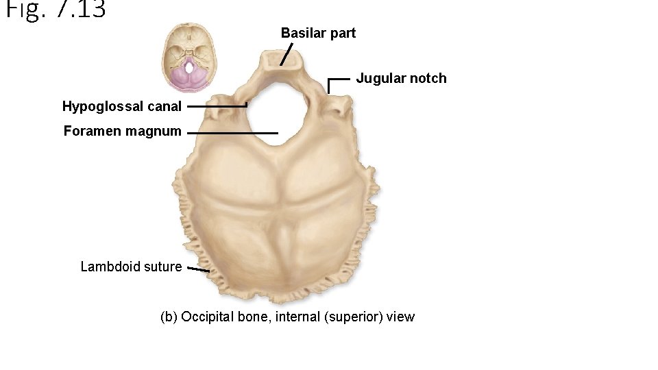 Fig. 7. 13 Basilar part Jugular notch Hypoglossal canal Foramen magnum Lambdoid suture (b)