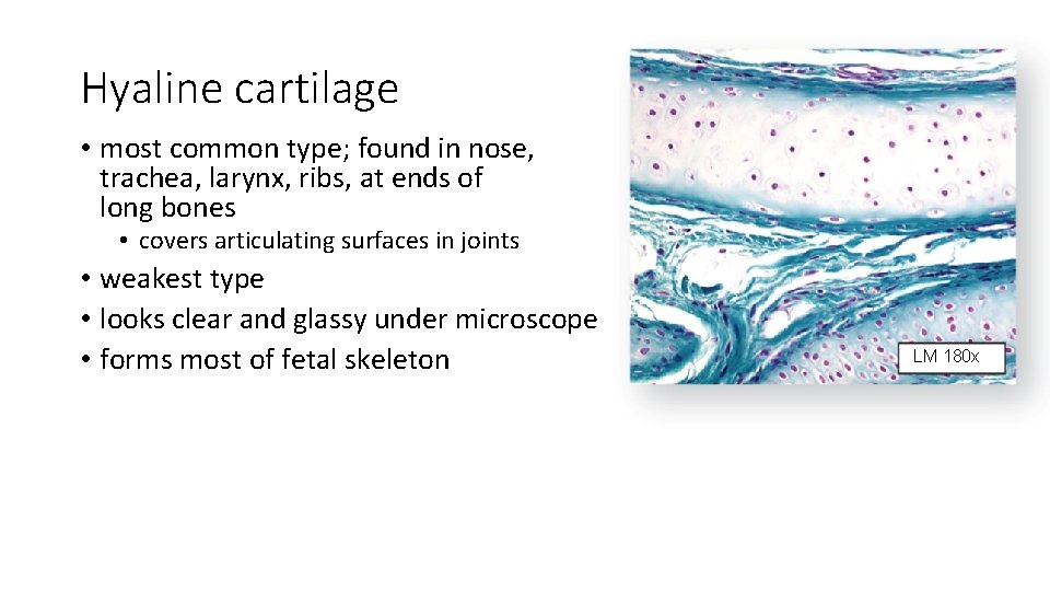 Hyaline cartilage • most common type; found in nose, trachea, larynx, ribs, at ends