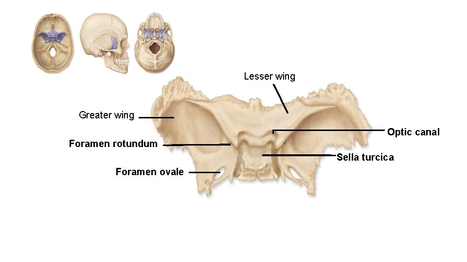 Lesser wing Greater wing Optic canal Foramen rotundum Sella turcica Foramen ovale 