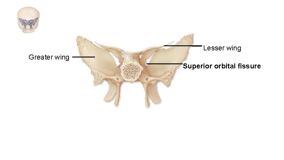 Lesser wing Greater wing Superior orbital fissure 