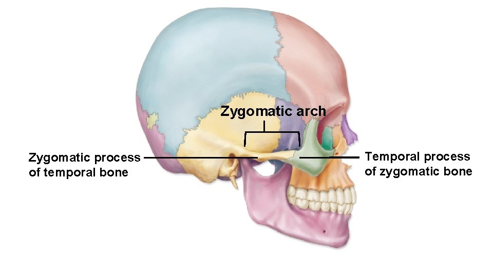 Zygomatic arch Zygomatic process of temporal bone Temporal process of zygomatic bone 