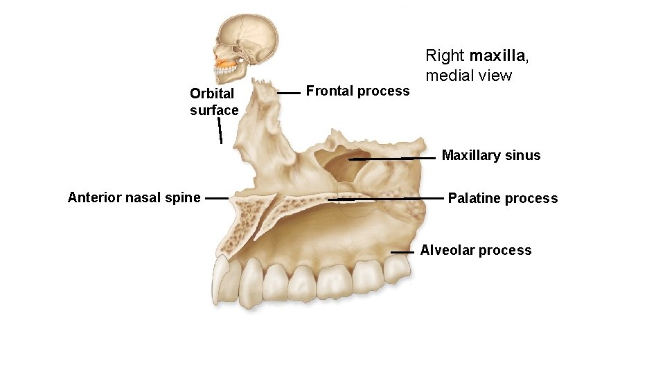 Orbital surface Frontal process Right maxilla, medial view Maxillary sinus Anterior nasal spine Palatine