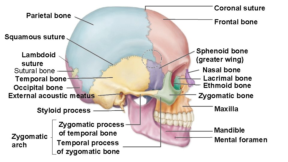 Parietal bone Coronal suture Frontal bone Squamous suture Lambdoid suture Sutural bone Temporal bone