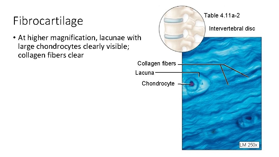 Table 4. 11 a-2 Fibrocartilage Intervertebral disc • At higher magnification, lacunae with large