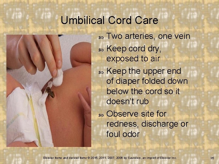 Umbilical Cord Care Two arteries, one vein Keep cord dry, exposed to air Keep