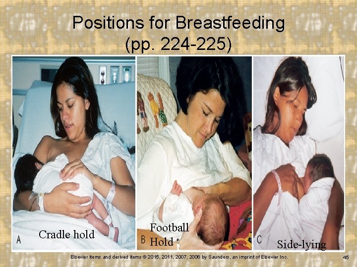 Positions for Breastfeeding (pp. 224 -225) Cradle hold Football Hold Side-lying Elsevier items and