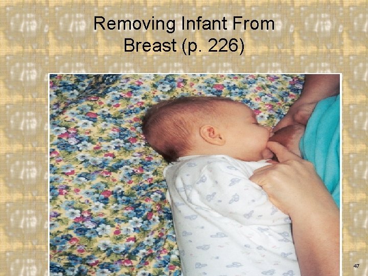 Removing Infant From Breast (p. 226) Elsevier items and derived items © 2015, 2011,