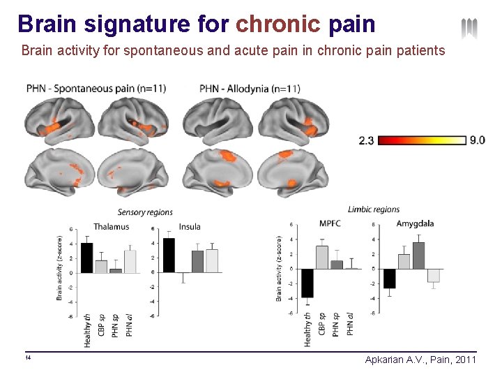 Brain signature for chronic pain Brain activity for spontaneous and acute pain in chronic