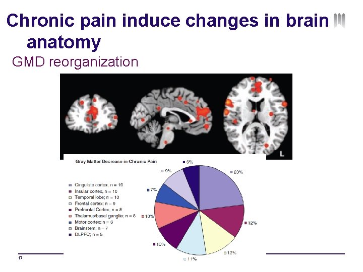 Chronic pain induce changes in brain anatomy GMD reorganization 17 