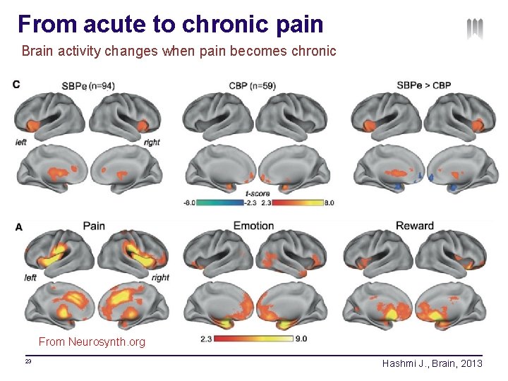 From acute to chronic pain Brain activity changes when pain becomes chronic From Neurosynth.