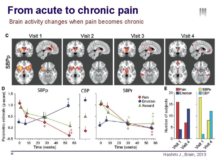 From acute to chronic pain Brain activity changes when pain becomes chronic 25 Hashmi