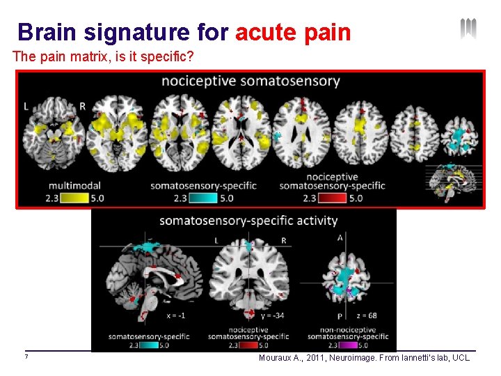 Brain signature for acute pain The pain matrix, is it specific? 7 Mouraux A.