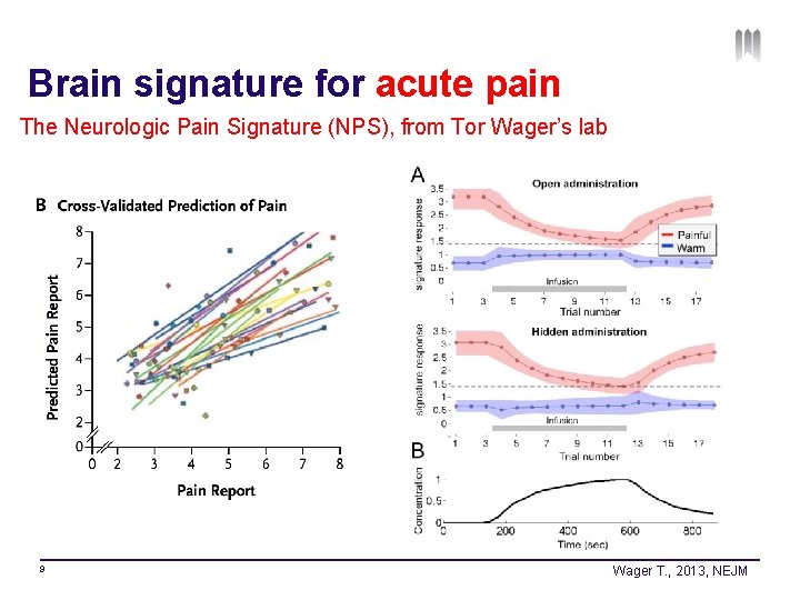 Brain signature for acute pain The Neurologic Pain Signature (NPS), from Tor Wager’s lab