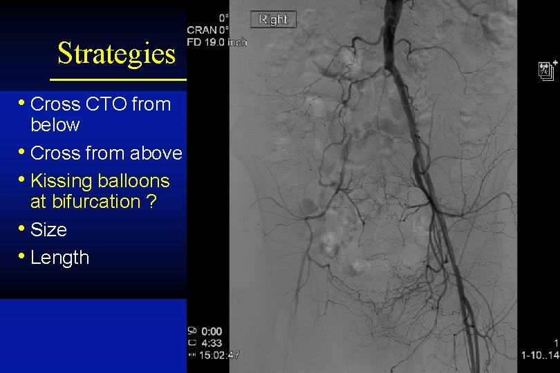 Strategies • Cross CTO from below • Cross from above • Kissing balloons at