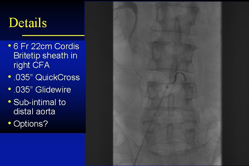 Details • 6 Fr 22 cm Cordis Britetip sheath in right CFA • .