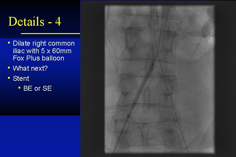 Details - 4 • Dilate right common • • iliac with 5 x 60