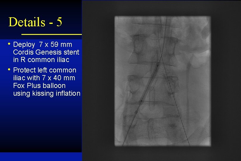 Details - 5 • Deploy 7 x 59 mm • Cordis Genesis stent in