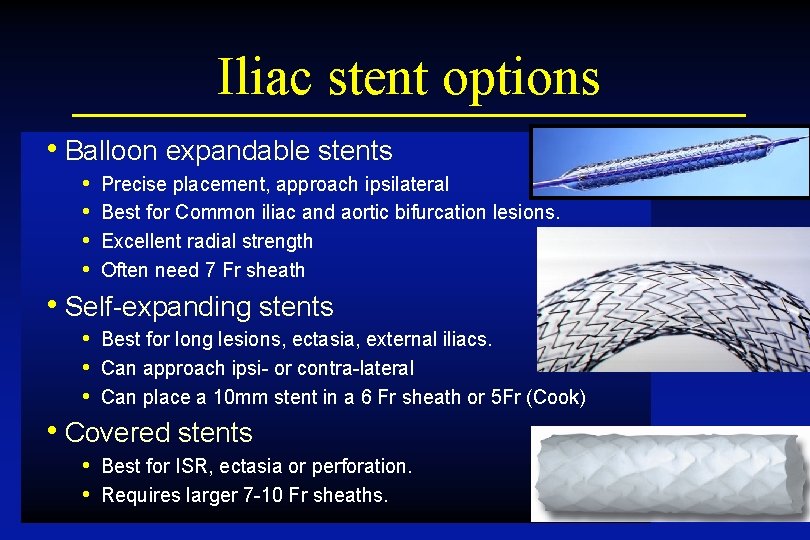 Iliac stent options • Balloon expandable stents • • Precise placement, approach ipsilateral Best