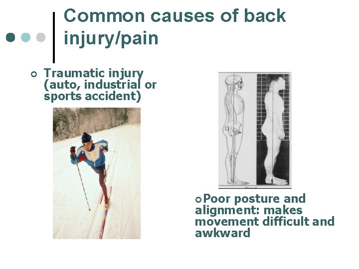 Common causes of back injury/pain ¢ Traumatic injury (auto, industrial or sports accident) ¢Poor