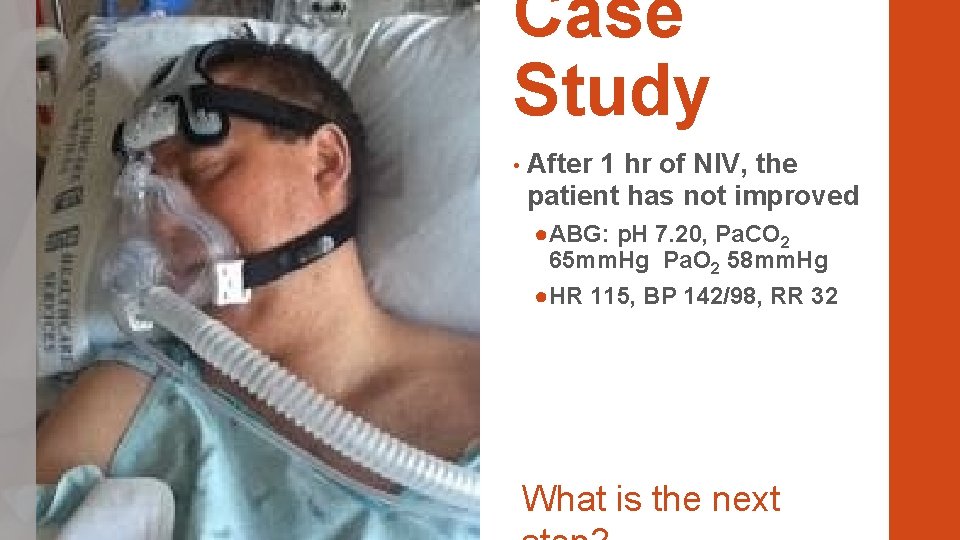 Case Study • After 1 hr of NIV, the patient has not improved ●ABG: