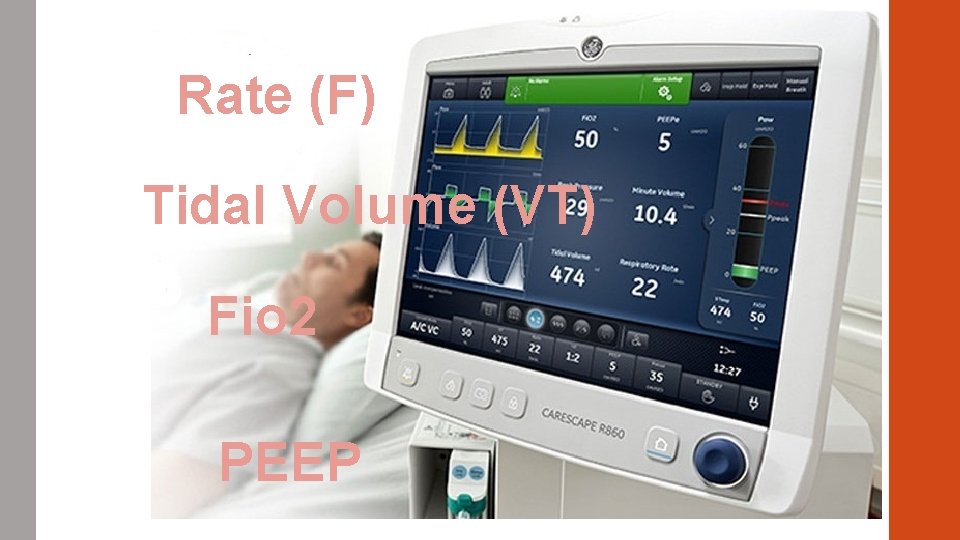 Rate (F) Tidal Volume (VT) Fio 2 PEEP 