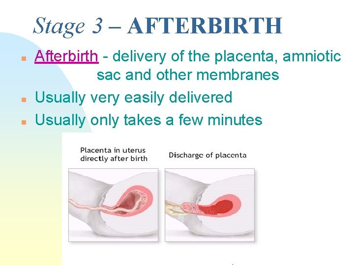Stage 3 – AFTERBIRTH n n n Afterbirth - delivery of the placenta, amniotic