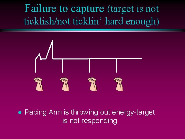 Failure to capture (target is not ticklish/not ticklin’ hard enough) l Pacing Arm is