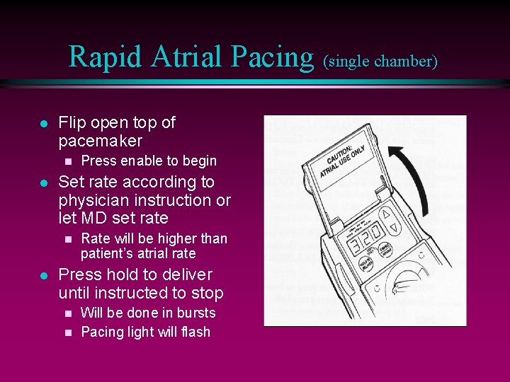 Rapid Atrial Pacing (single chamber) l Flip open top of pacemaker n l Set