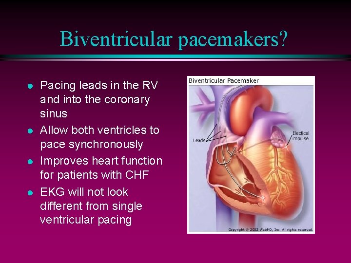 Biventricular pacemakers? l l Pacing leads in the RV and into the coronary sinus