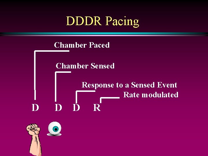 DDDR Pacing Chamber Paced Chamber Sensed Response to a Sensed Event Rate modulated D
