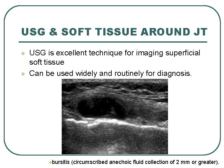 USG & SOFT TISSUE AROUND JT l l USG is excellent technique for imaging