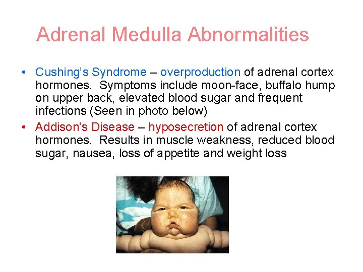 Adrenal Medulla Abnormalities • Cushing’s Syndrome – overproduction of adrenal cortex hormones. Symptoms include