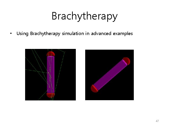 Brachytherapy • Using Brachytherapy simulation in advanced examples 47 