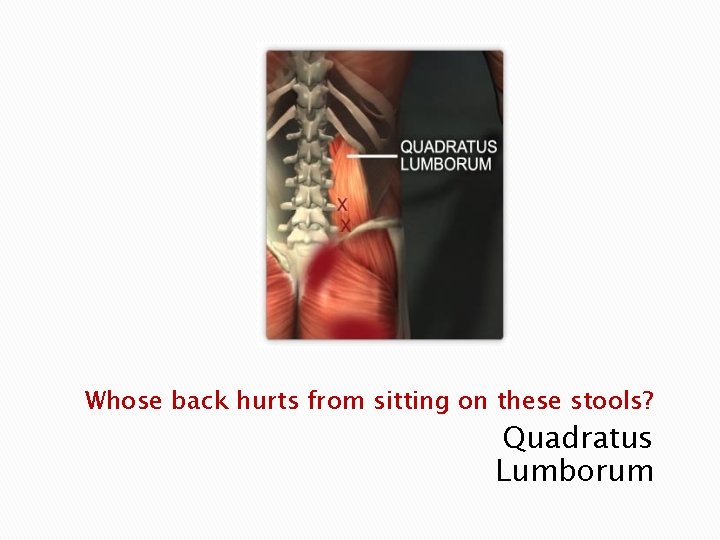 Whose back hurts from sitting on these stools? Quadratus Lumborum 