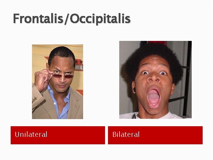 Frontalis/Occipitalis Unilateral Bilateral 