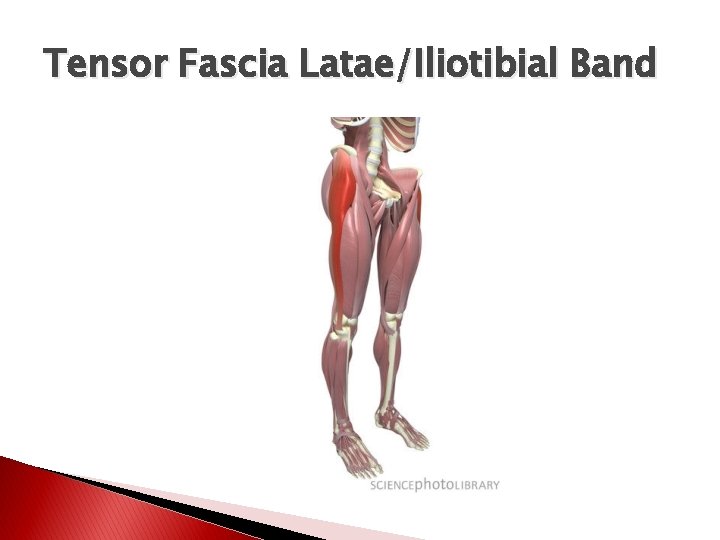 Tensor Fascia Latae/Iliotibial Band 
