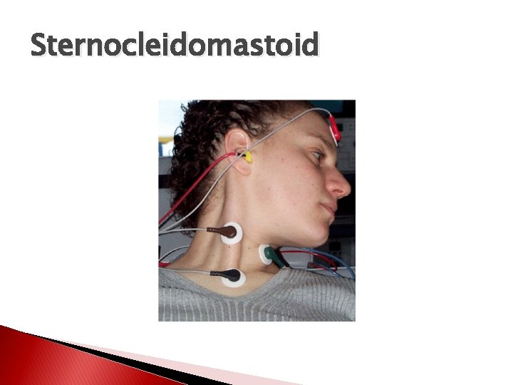 Sternocleidomastoid 