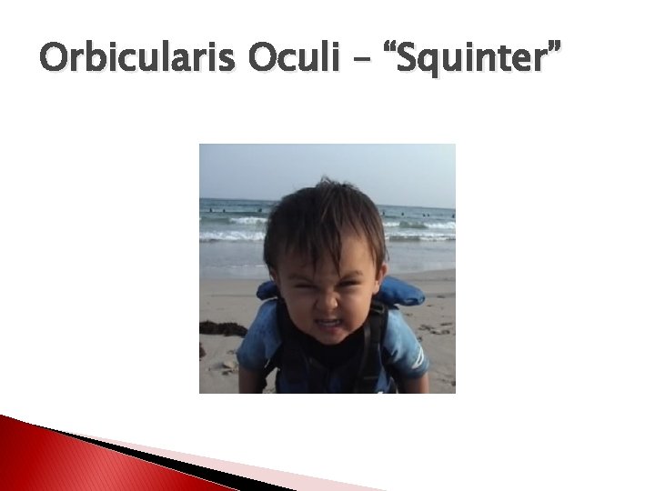 Orbicularis Oculi – “Squinter” 