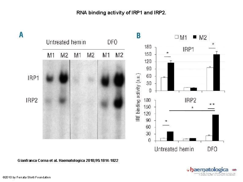 RNA binding activity of IRP 1 and IRP 2. Gianfranca Corna et al. Haematologica