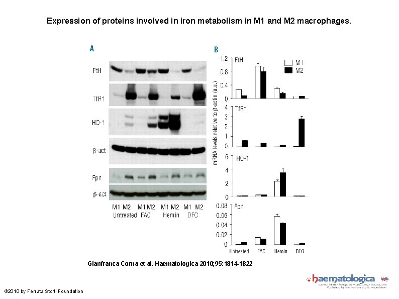 Expression of proteins involved in iron metabolism in M 1 and M 2 macrophages.