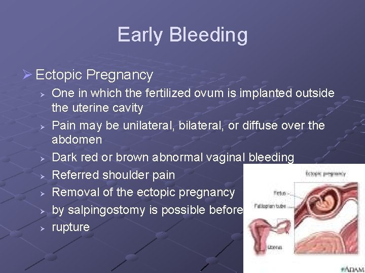 Early Bleeding Ø Ectopic Pregnancy Ø Ø Ø Ø One in which the fertilized