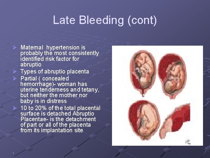 Late Bleeding (cont) Ø Maternal hypertension is probably the most consistently identified risk factor