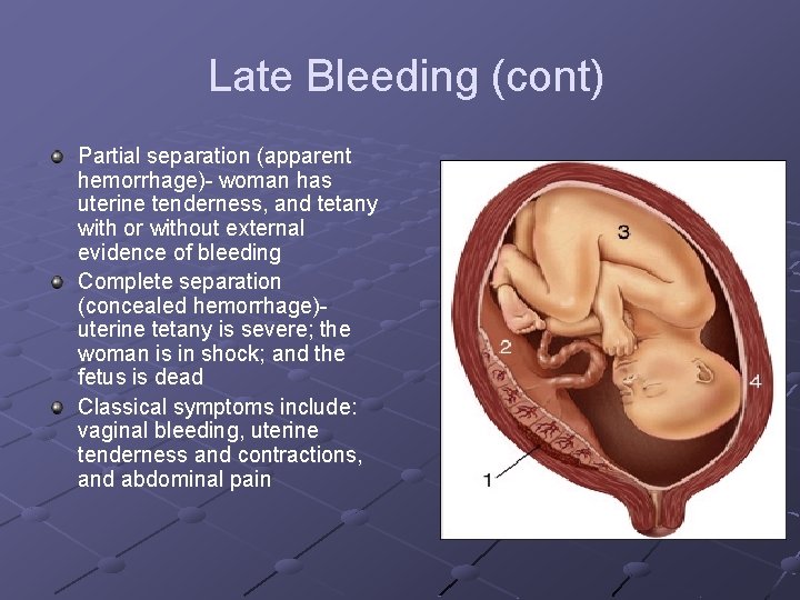 Late Bleeding (cont) Partial separation (apparent hemorrhage)- woman has uterine tenderness, and tetany with