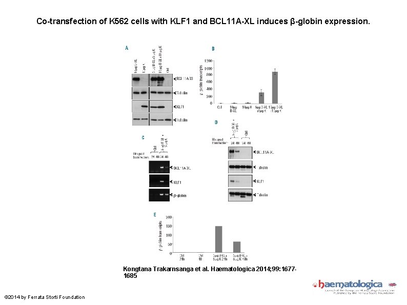 Co-transfection of K 562 cells with KLF 1 and BCL 11 A-XL induces β-globin
