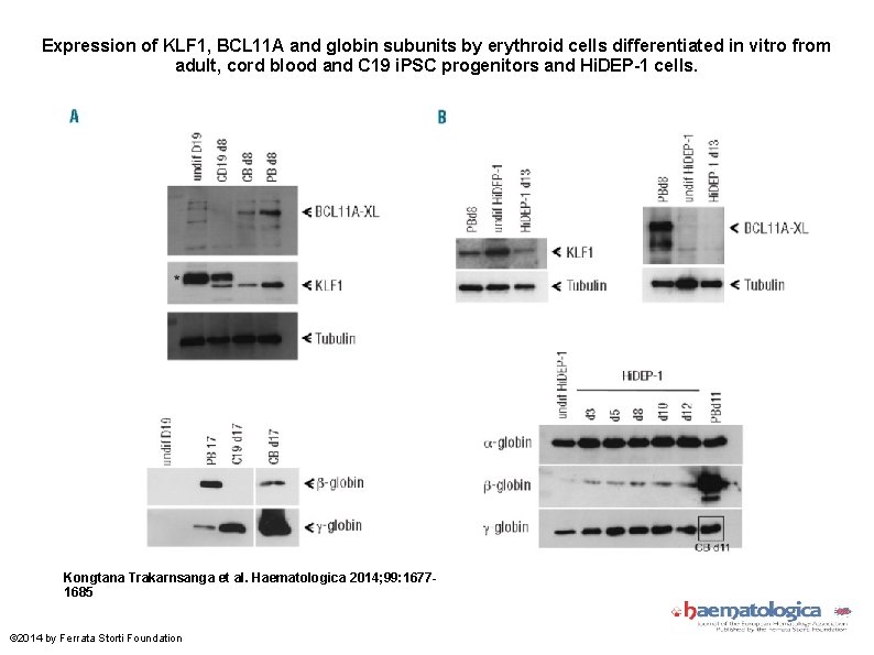 Expression of KLF 1, BCL 11 A and globin subunits by erythroid cells differentiated