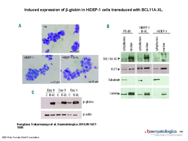 Induced expression of β-globin in Hi. DEP-1 cells transduced with BCL 11 A-XL. Kongtana