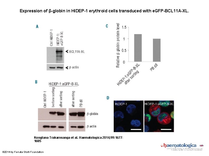 Expression of β-globin in Hi. DEP-1 erythroid cells transduced with e. GFP-BCL 11 A-XL.